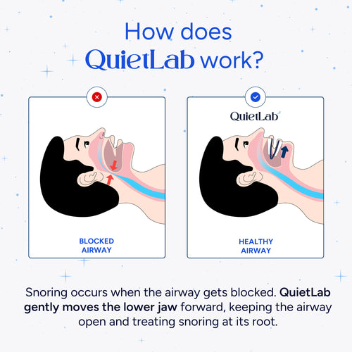 QuietLab Pro® Adjustable  Anti-Snoring Mouthpiece